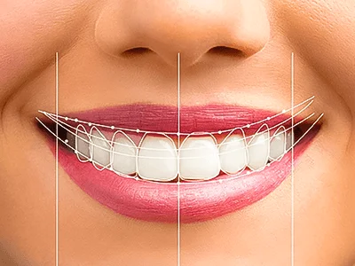 Smile Design: Building your confidence