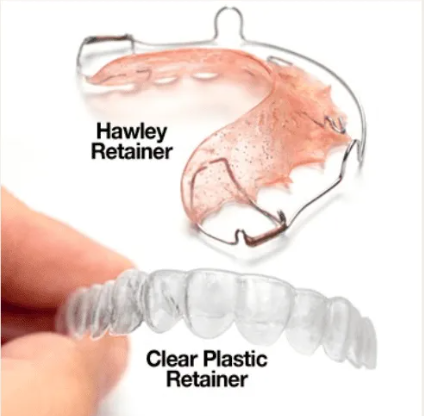 Why Retainers Matter After Braces: Know Your Options