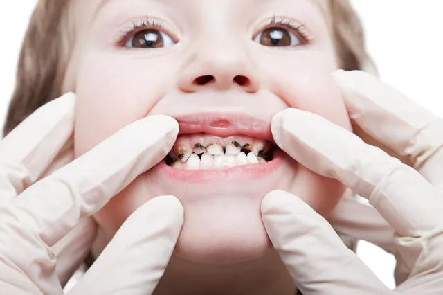 Little Smiles, Big Care: Children’s Dentistry 101