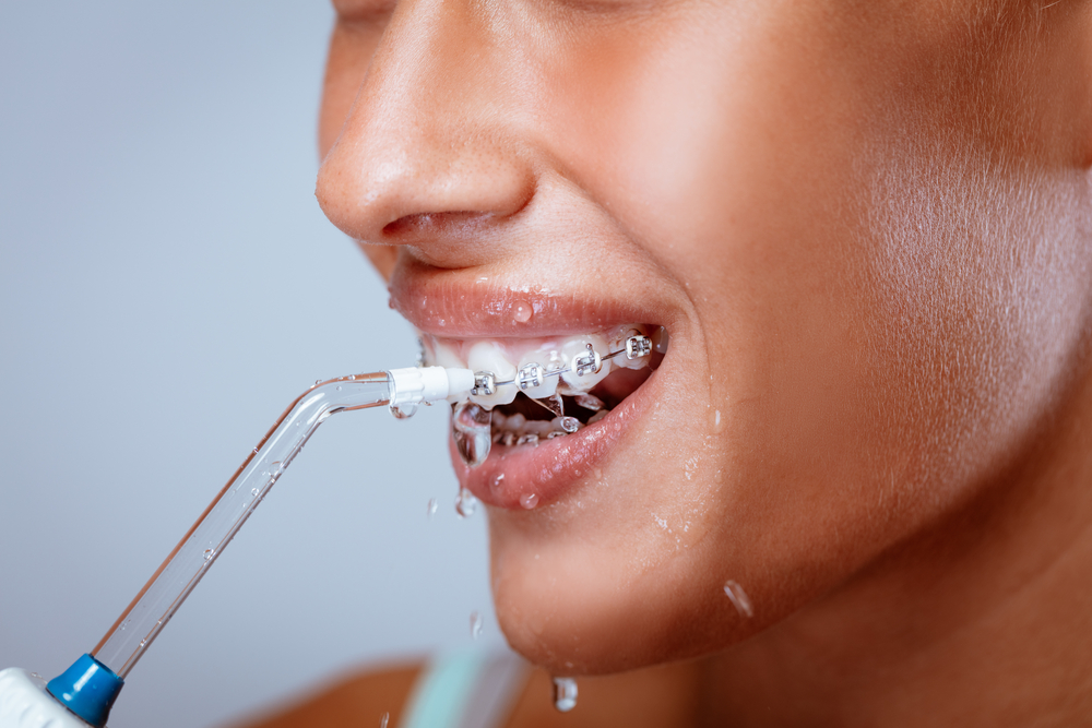 Floss Smarter, Smile Brighter: Truth About Flossing !